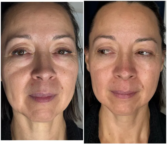 La Belle Skincare Studio Picture 7