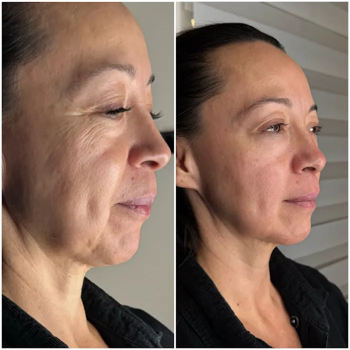 La Belle Skincare Studio Picture 10