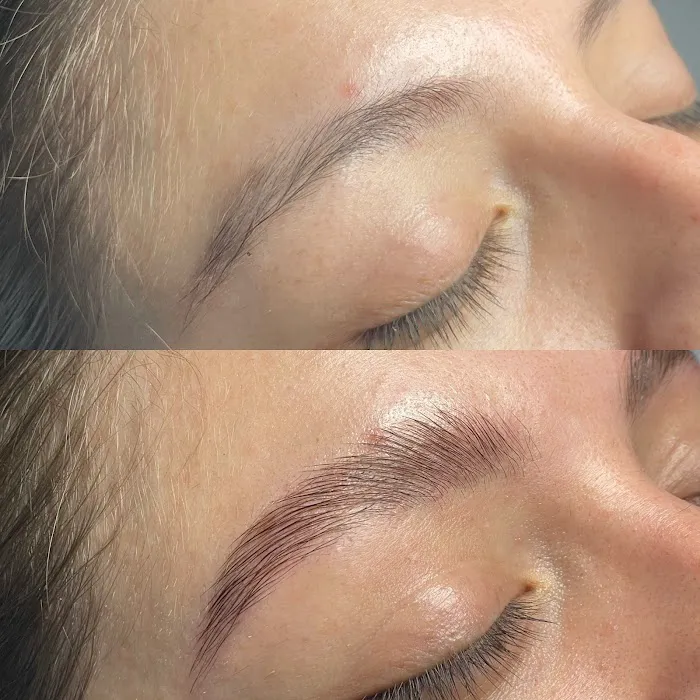 Skin by Christine Picture 1