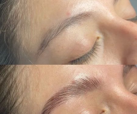 Skin by Christine