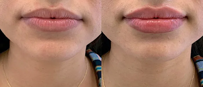 Ajliss Medical Aesthetics Picture 4