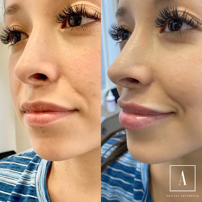 Ajliss Medical Aesthetics Picture 9