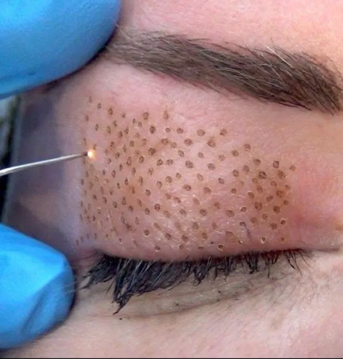 Skin Tightening Solution Picture 2