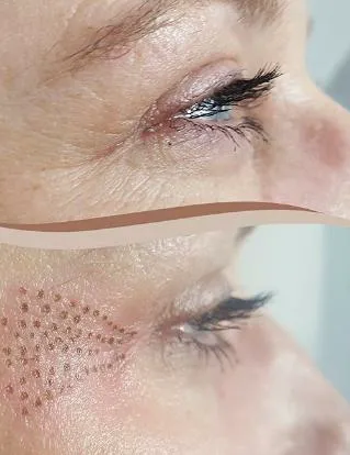 Skin Tightening Solution Picture 3