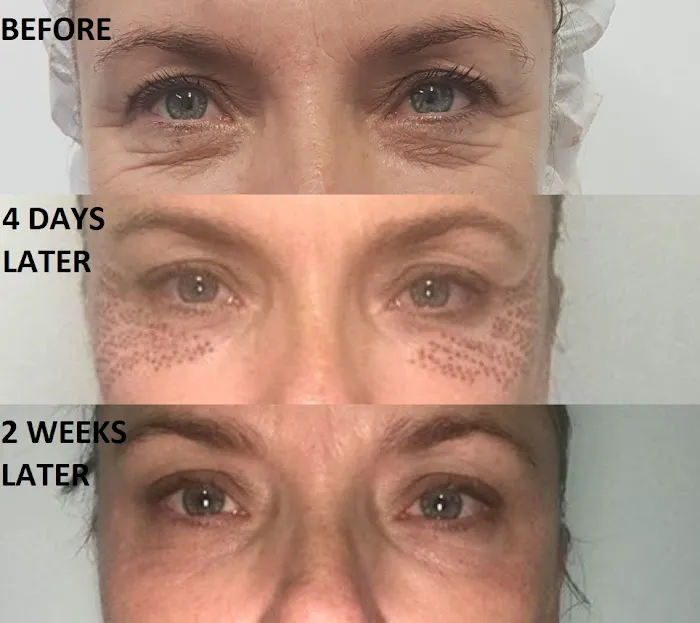 Skin Tightening Solution Picture 5