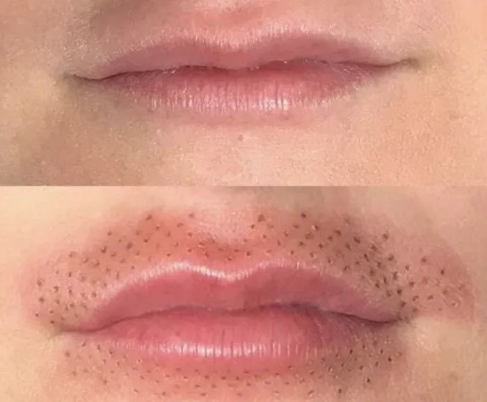 Skin Tightening Solution Picture 4