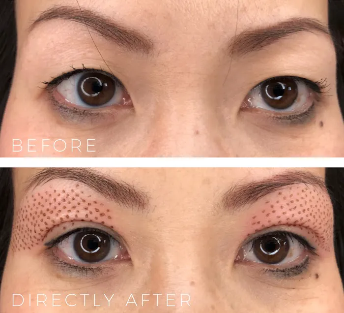 Skin Tightening Solution Picture 6