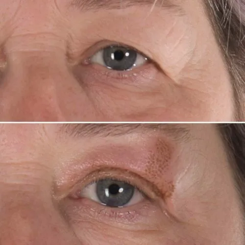 Skin Tightening Solution Picture 9