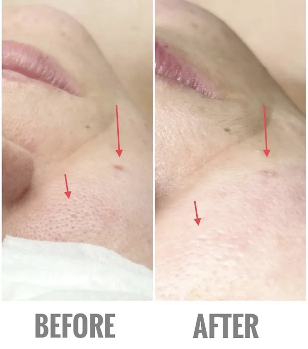 Babyface Skincare & Lash Studio Picture 2