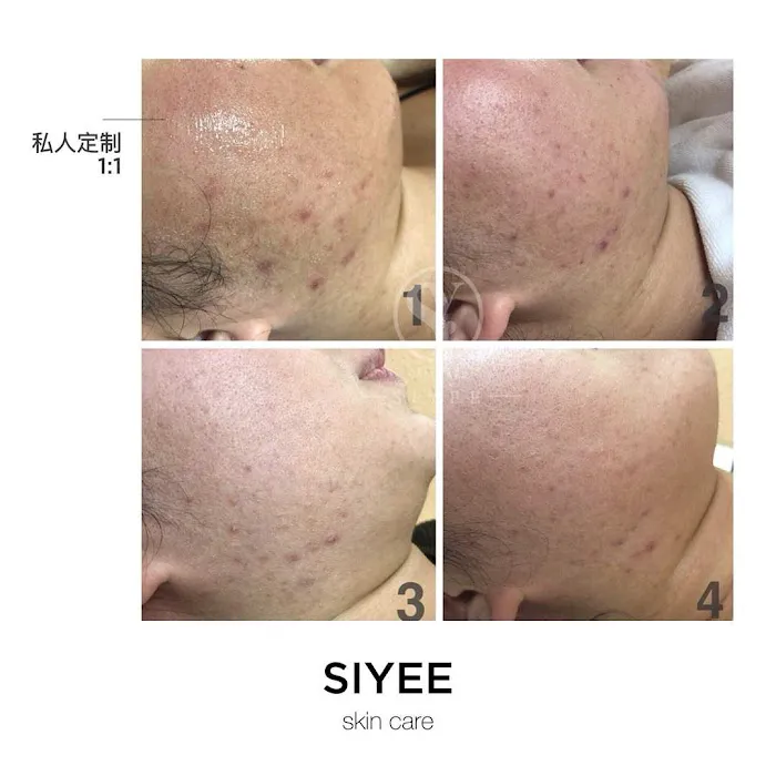 SIYEE皮肤管理中心 Picture 2