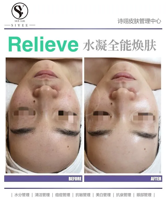 SIYEE皮肤管理中心 Picture 6