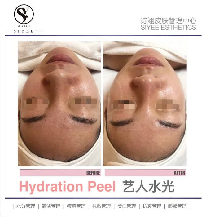 SIYEE皮肤管理中心 Picture 10
