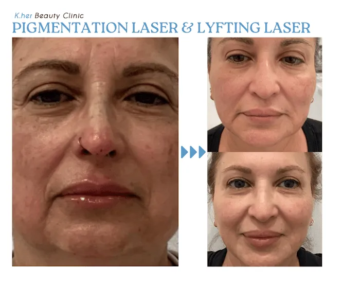 K.her Beauty Clinic Picture 5