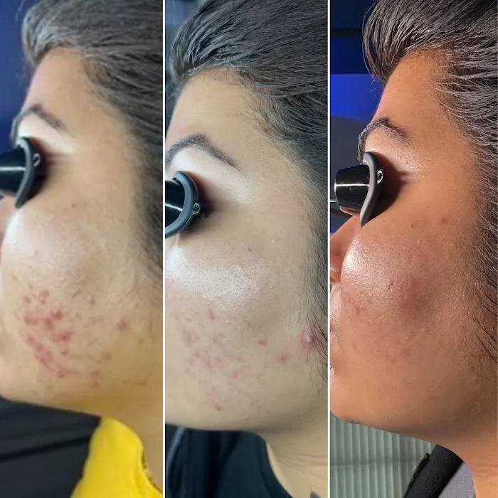 Threo Skin Picture 1