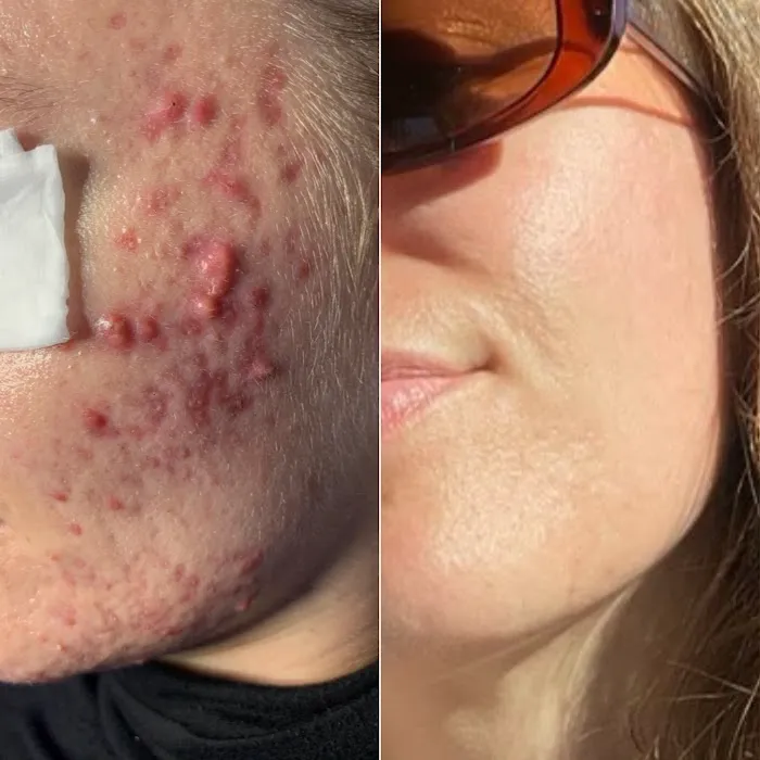 Threo Skin Picture 3