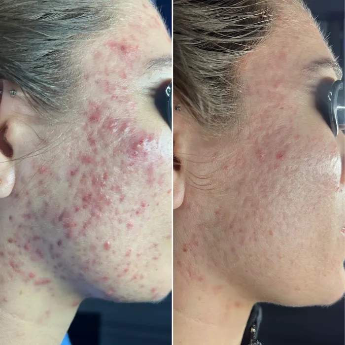 Threo Skin Picture 4