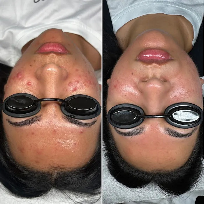 Threo Skin Picture 2