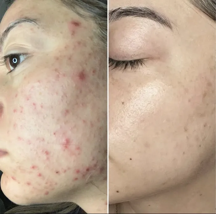 Threo Skin Picture 5