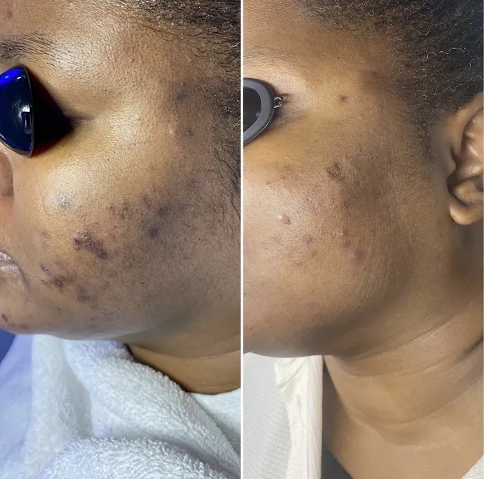 Threo Skin Picture 6