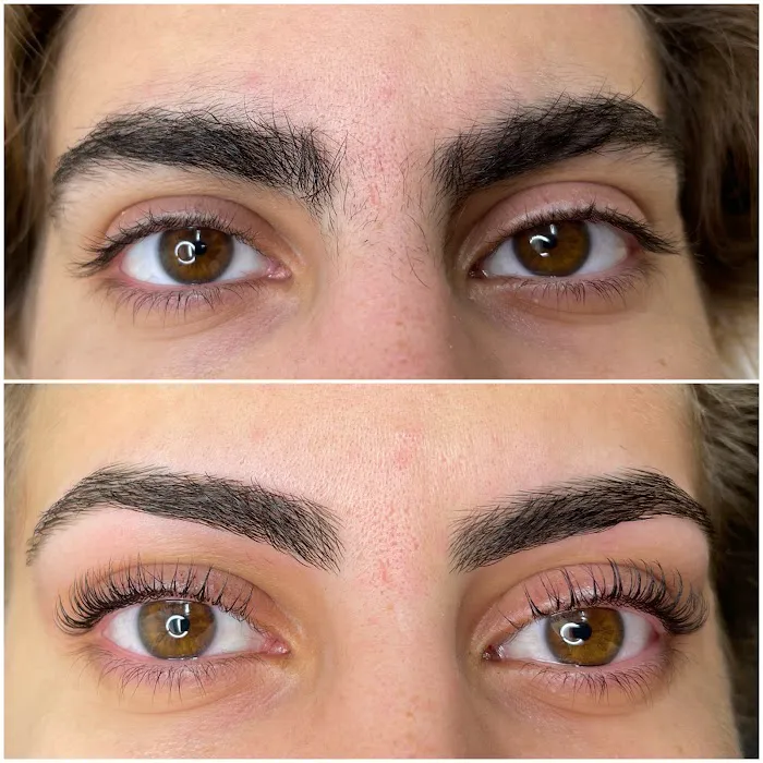 Revision Esthetics Picture 3