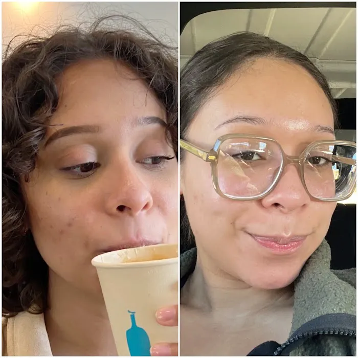 Revision Esthetics Picture 5