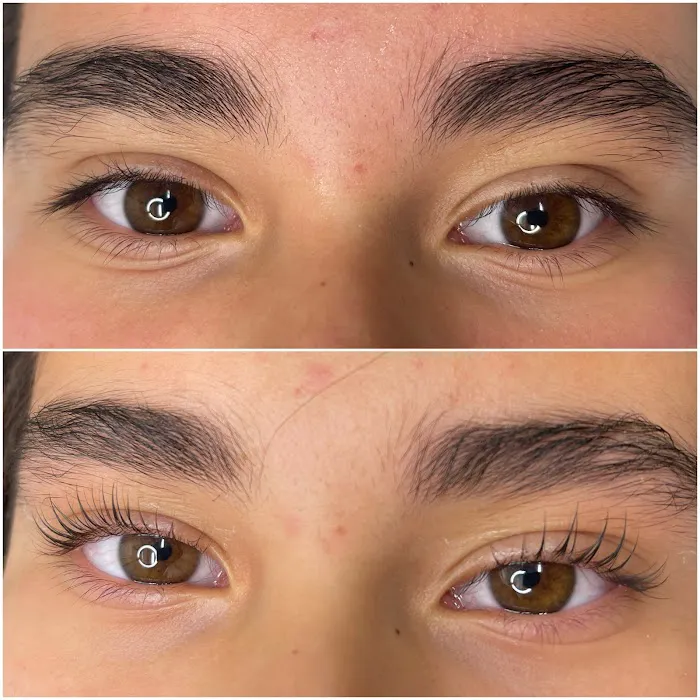 Revision Esthetics Picture 7