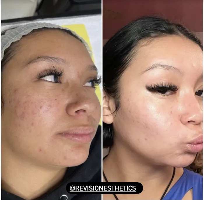 Revision Esthetics Picture 8
