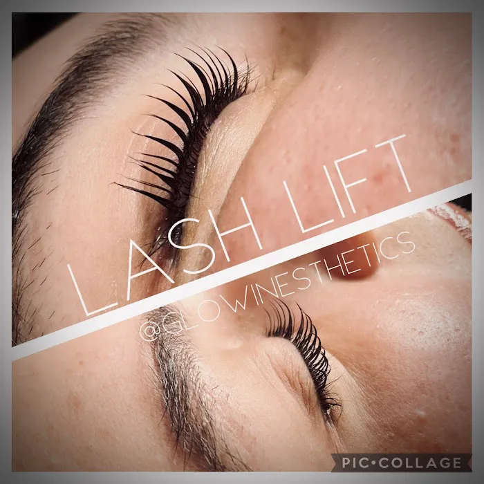 GlowIn Esthetics Picture 4