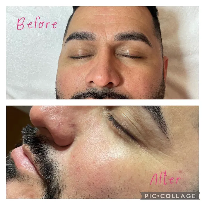 GlowIn Esthetics Picture 7