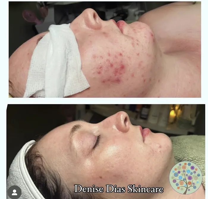Denise Dias Skincare Picture 7