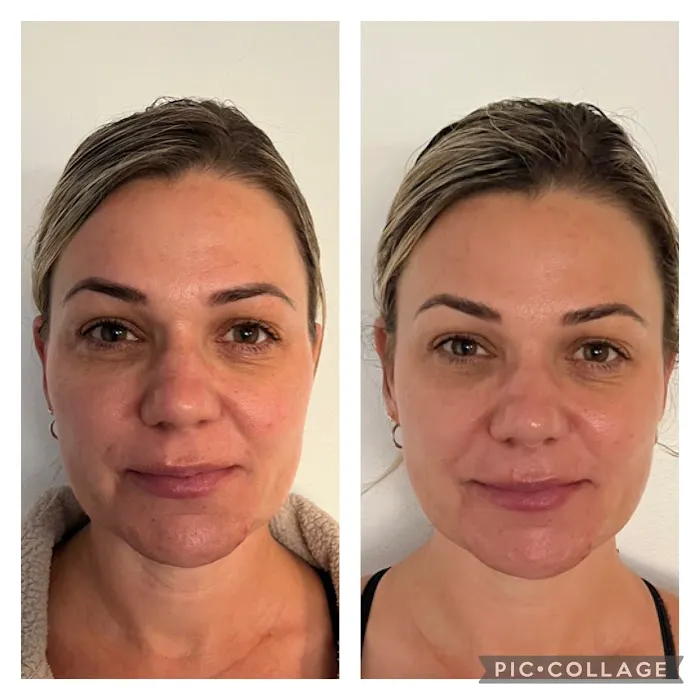 Laura Vera Skin Picture 10