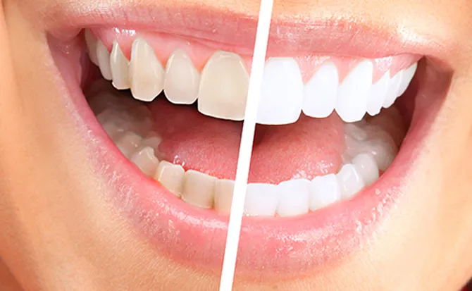 La Beaute Spa & Permanent Makeup Center Picture 3