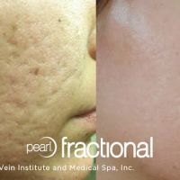 Advanced Dermatology Institute ico