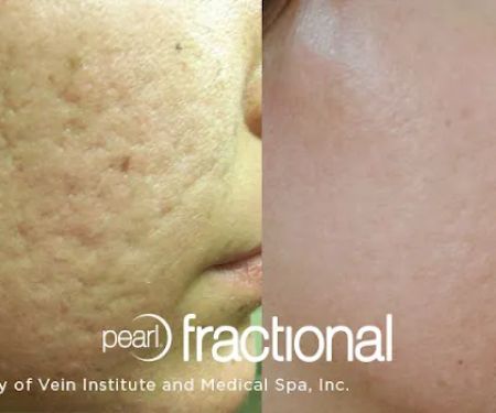 Advanced Dermatology Institute