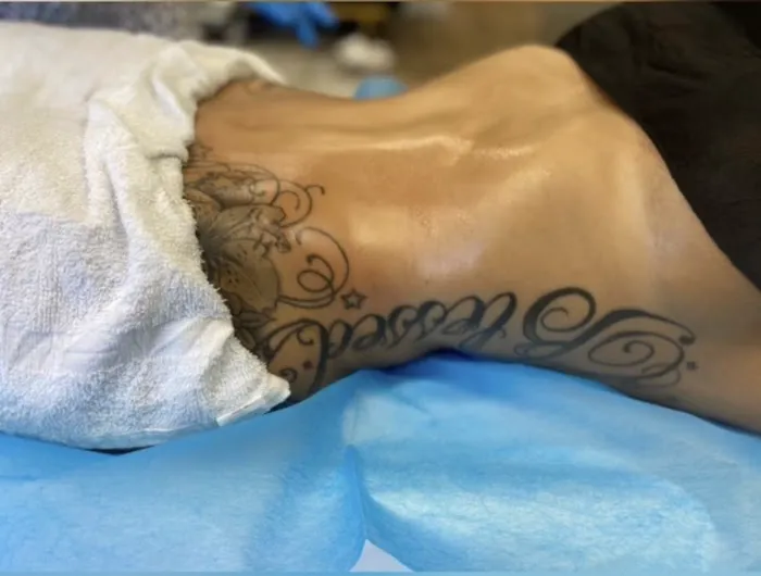 SKIN DRIPP Picture 4