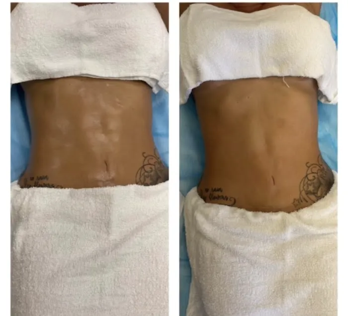 SKIN DRIPP Picture 8