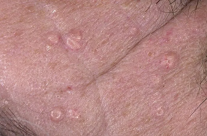 Los Angeles-Skincare Picture 4