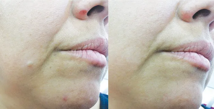 Los Angeles-Skincare Picture 5