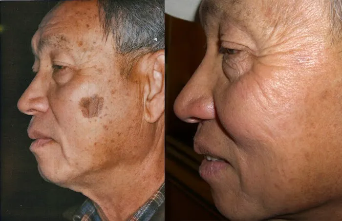 Los Angeles-Skincare Picture 7