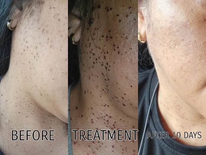 Los Angeles-Skincare Picture 9