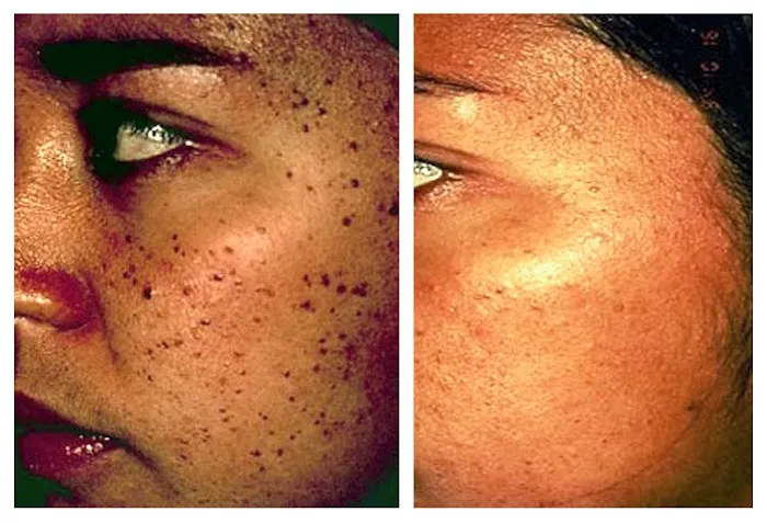 Los Angeles-Skincare Picture 10