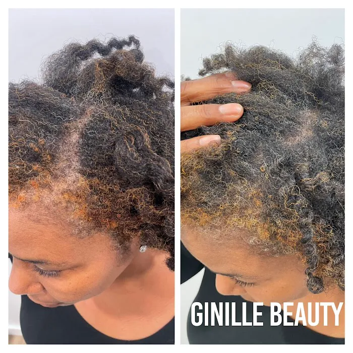 Ginille Beauty Aesthetics Picture 3