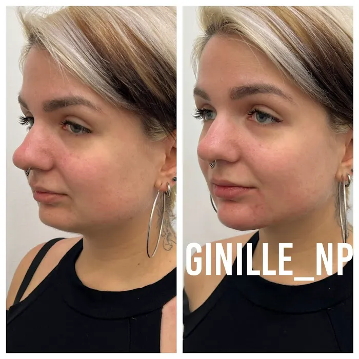 Ginille Beauty Aesthetics Picture 8