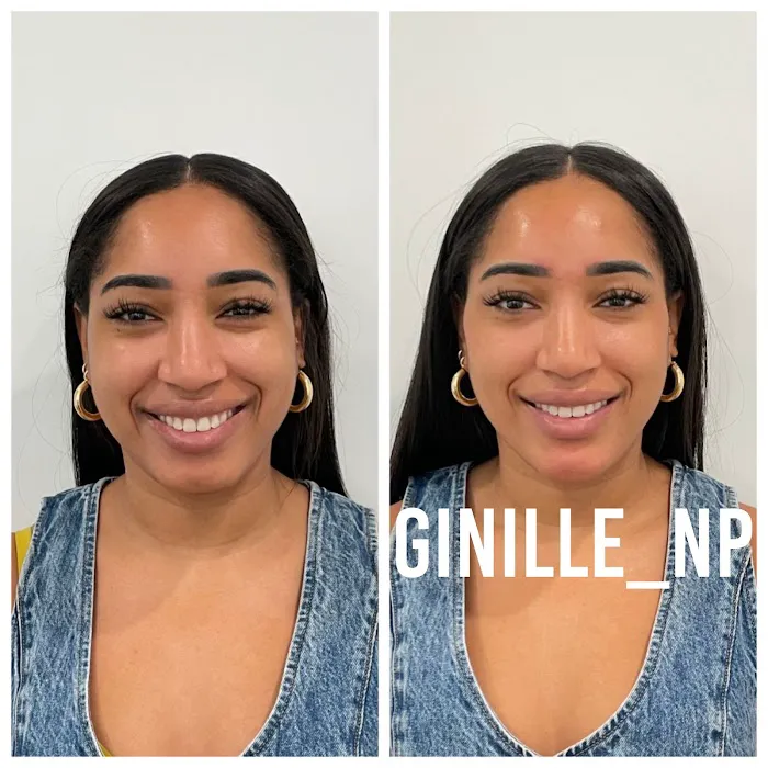 Ginille Beauty Aesthetics Picture 9