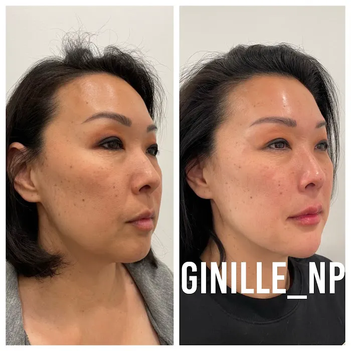 Ginille Beauty Aesthetics Picture 10