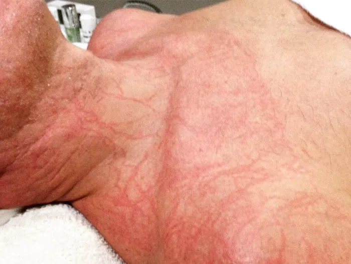 Skin Guardian Picture 5