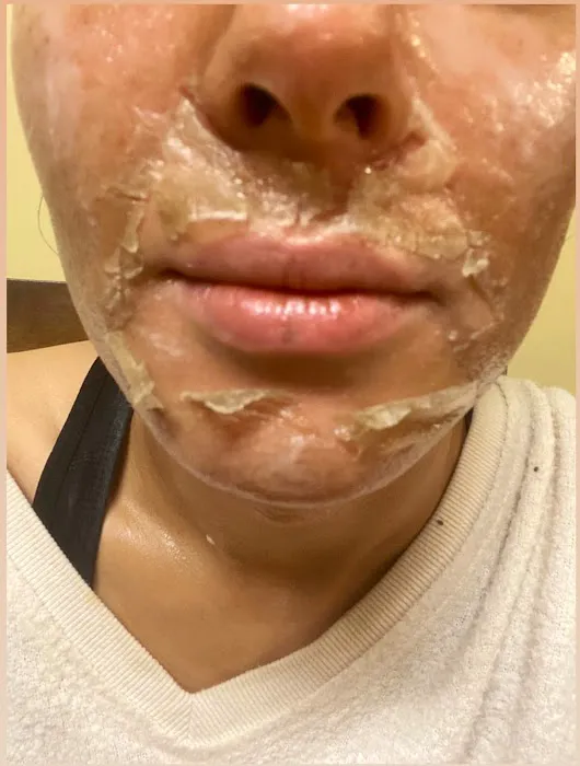 Skin Guardian Picture 3