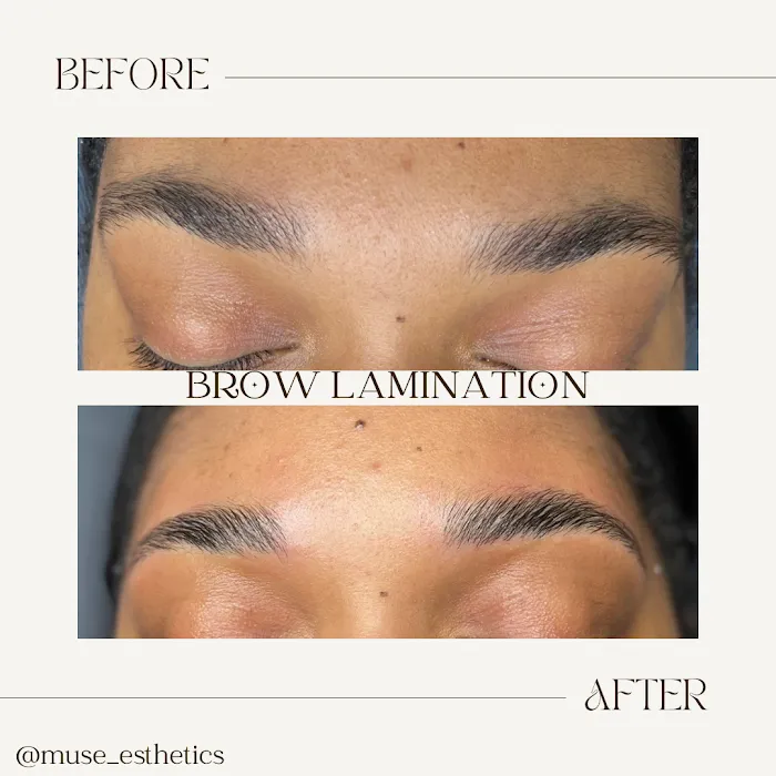 Muse Esthetics Picture 2