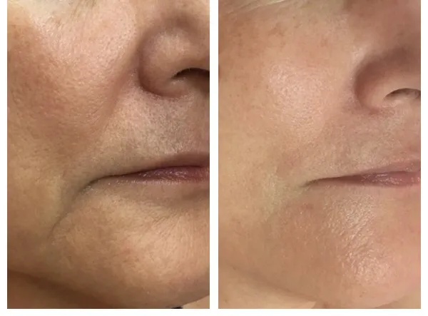 Jenny's Beauty Picture 6