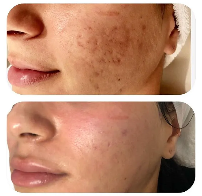 Jenny's Beauty Picture 7